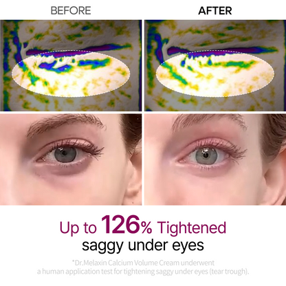 Calcium Eye care Line