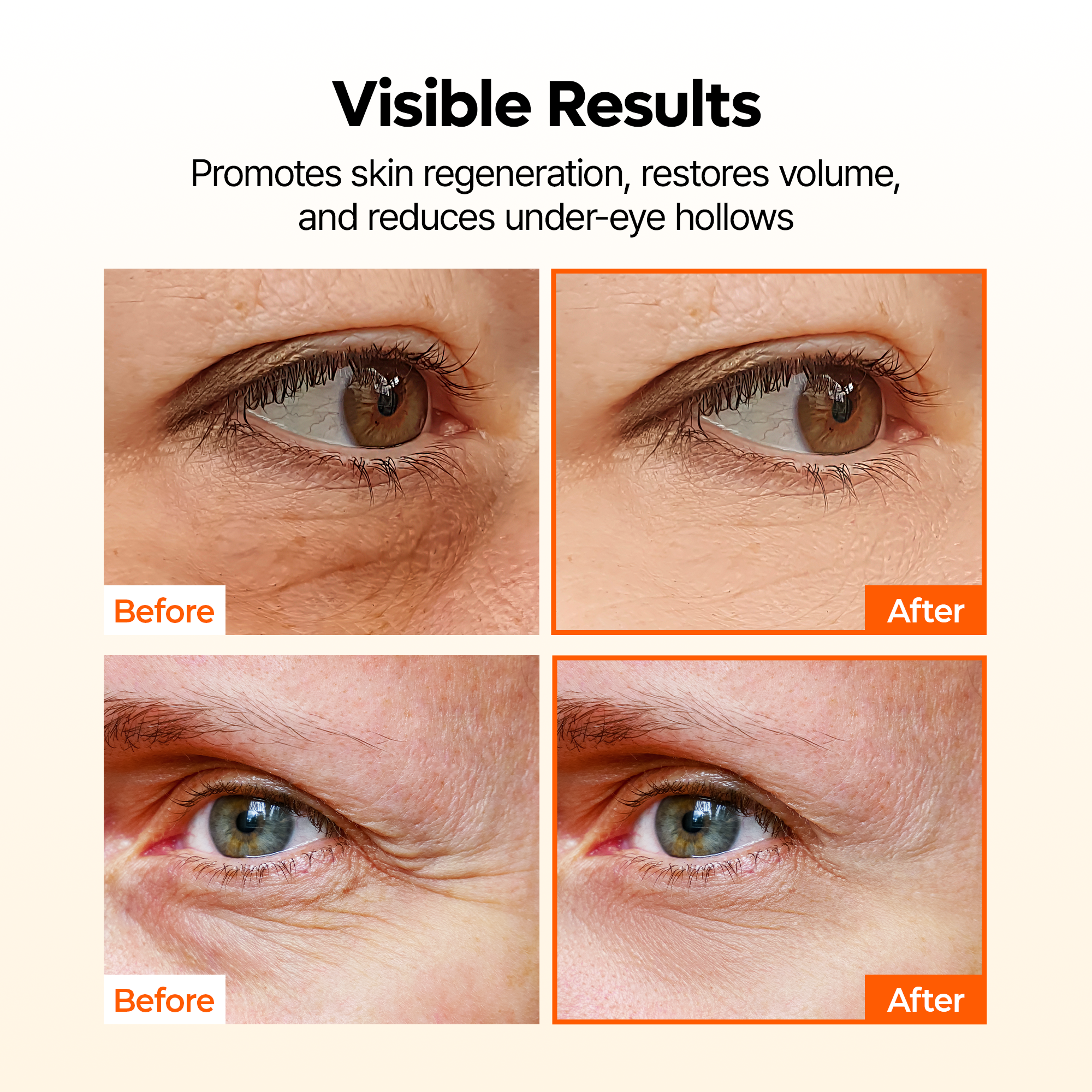 TX-Kojic Acid Retinal Eye patch