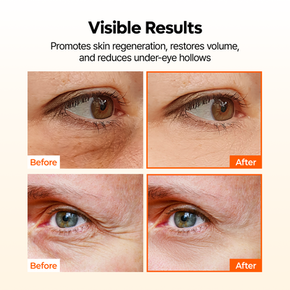 TX-Kojic Acid Retinal Eye patch