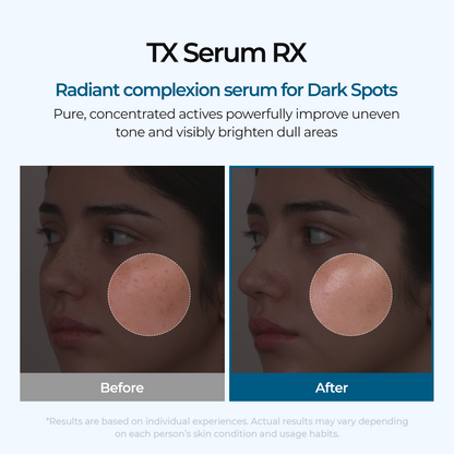 TX Ampoule Rx